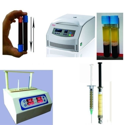 6/8x15ml thiết bị ly tâm PRP di động 0-4000rpm Cho bệnh viện phẫu thuật thẩm mỹ