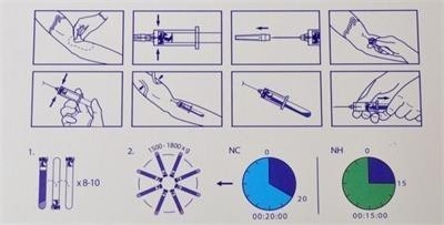 6/8x15ml thiết bị ly tâm PRP di động 0-4000rpm Cho bệnh viện phẫu thuật thẩm mỹ